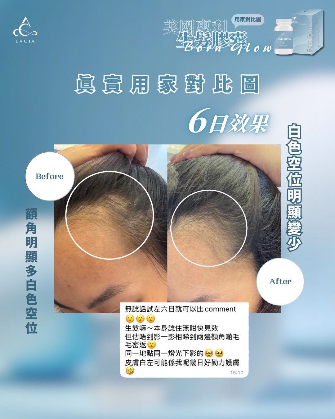 Born Glow 日本頭髮爆爆丸