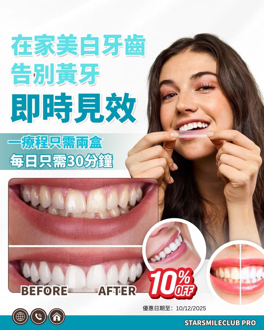 美國StarSmileClub Pro專業美白牙齒貼