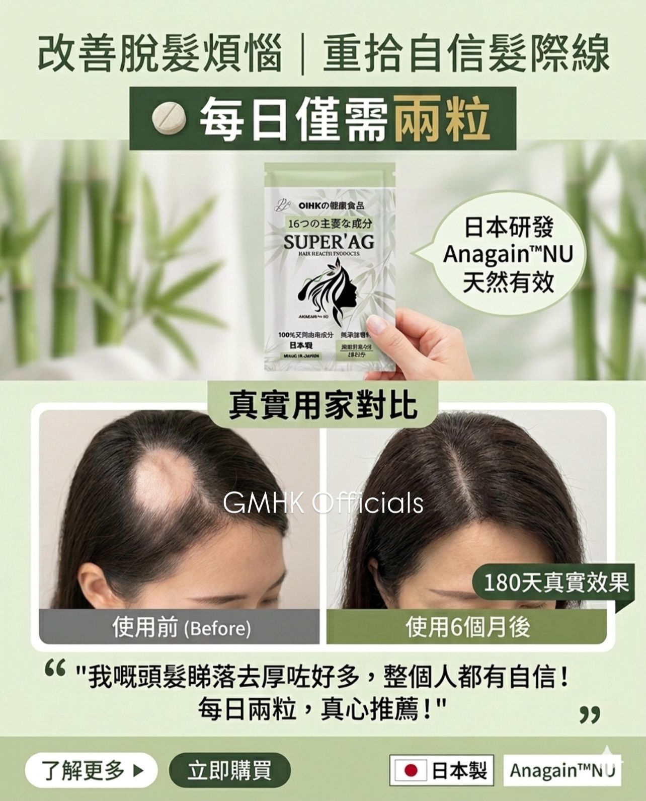 現貨 日本SUPER AG+ 生髮丸 Super AG Plus